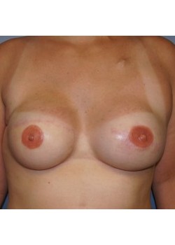 After Image