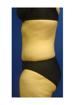 After Image