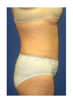 After Image