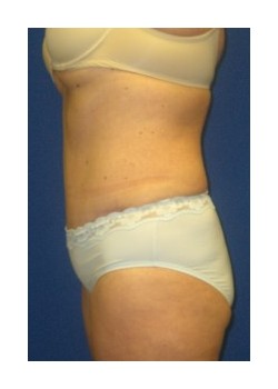 After Image