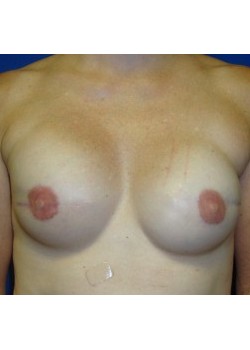After Image