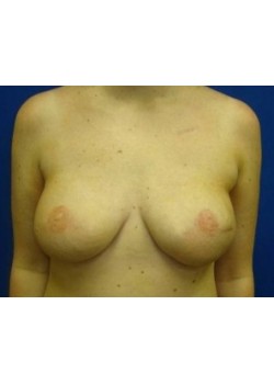After Image