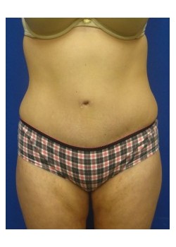 After Image