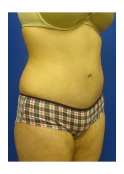 After Image