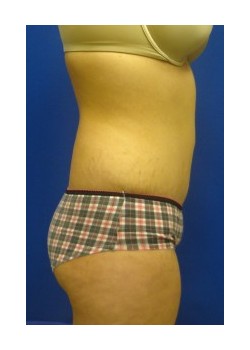 After Image