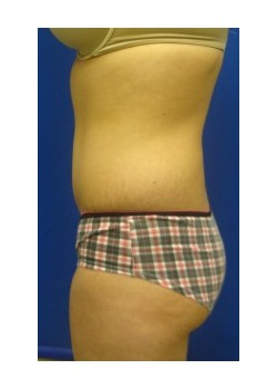After Image