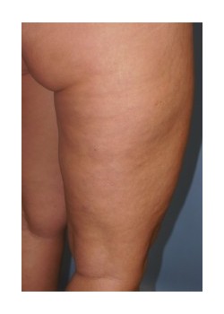 After Image