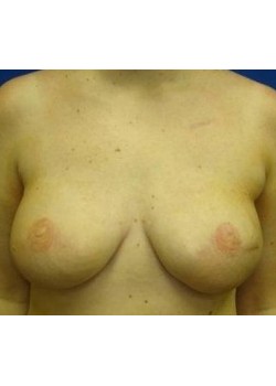 After Image