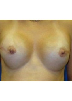 After Image