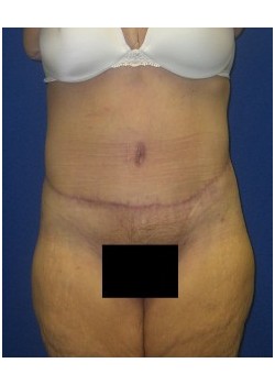 After Image