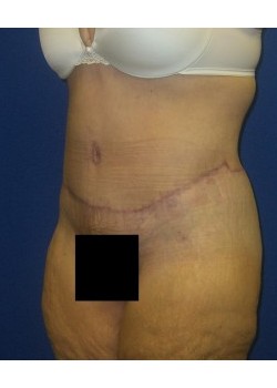 After Image