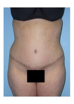 After Image