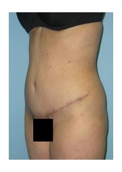 After Image