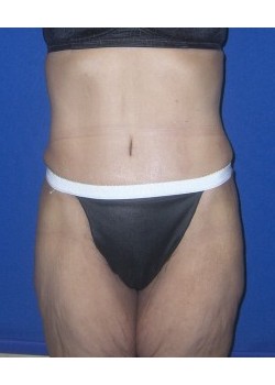 After Image