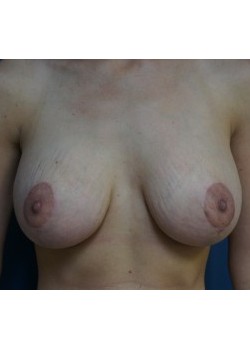 After Image