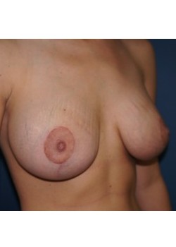After Image