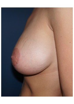 After Image