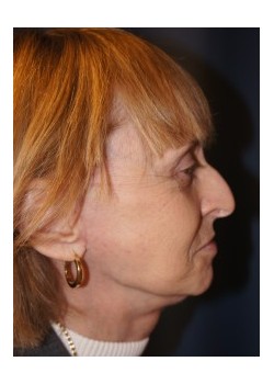 After Image