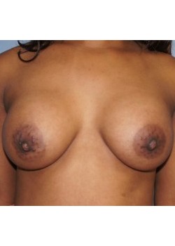 After Image