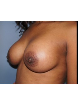 After Image