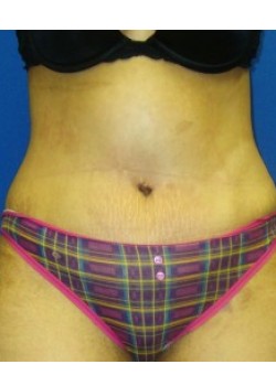 After Image