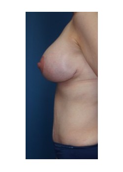 After Image