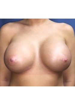 After Image