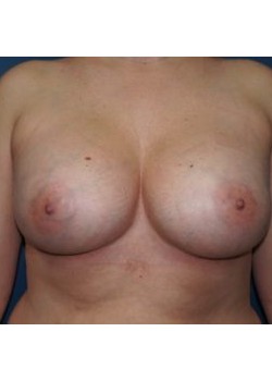 After Image