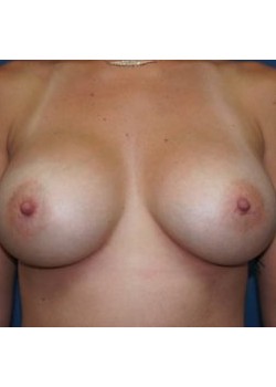 After Image
