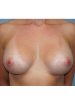 After Image