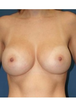 After Image
