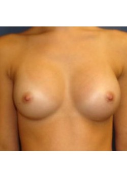 After Image