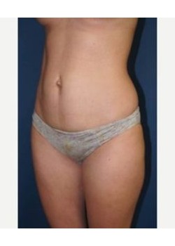 After Image