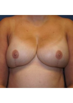 After Image