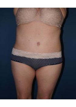 After Image