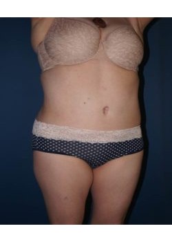 After Image