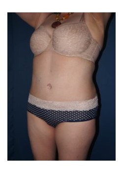 After Image