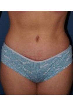 After Image