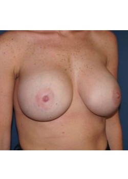After Image