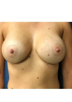After Image