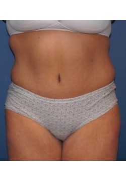 After Image