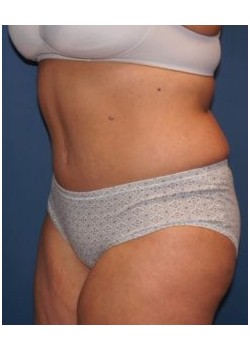 After Image