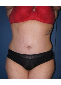 After Image