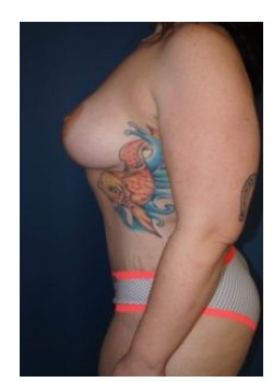 After Image