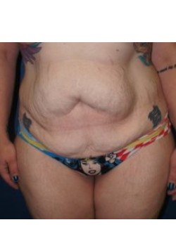 Before Image