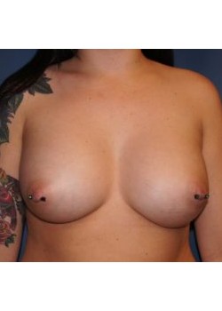 After Image
