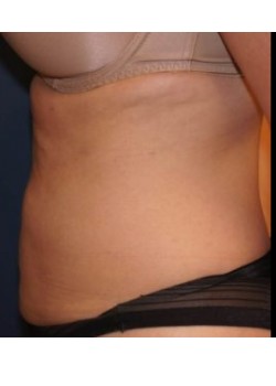 After Image