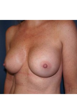 After Image