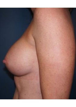 After Image