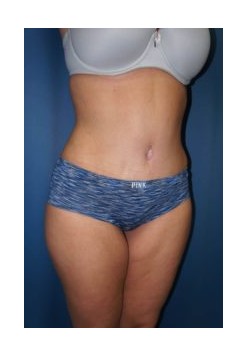 After Image